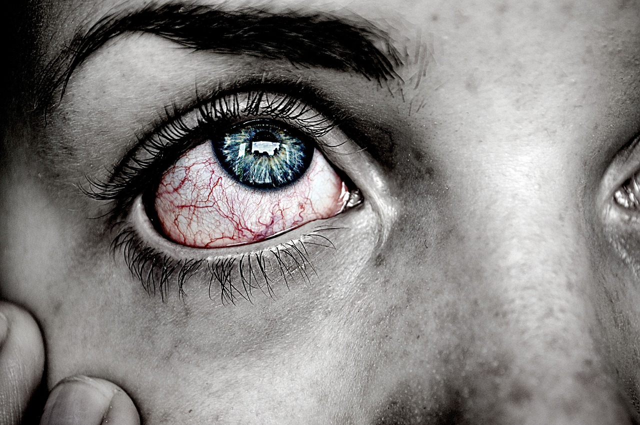 száraz szem kezelése házilag neu glow pro anti aging krém