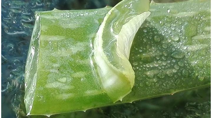 Bárányhimlő és az aloe vera használata