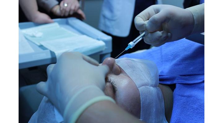 Hialuronsav előnyei, anti-aging